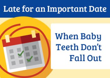 Abilene dentists, Dr. Webb & Dr. Awtrey at Abilene Family Dentistry, discuss the causes and treatment options of over-retained baby teeth that don’t come out naturally on their own.